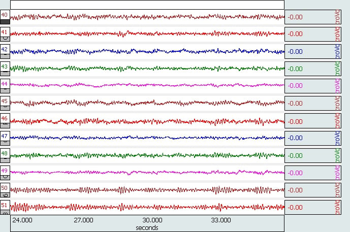 Raw EEG